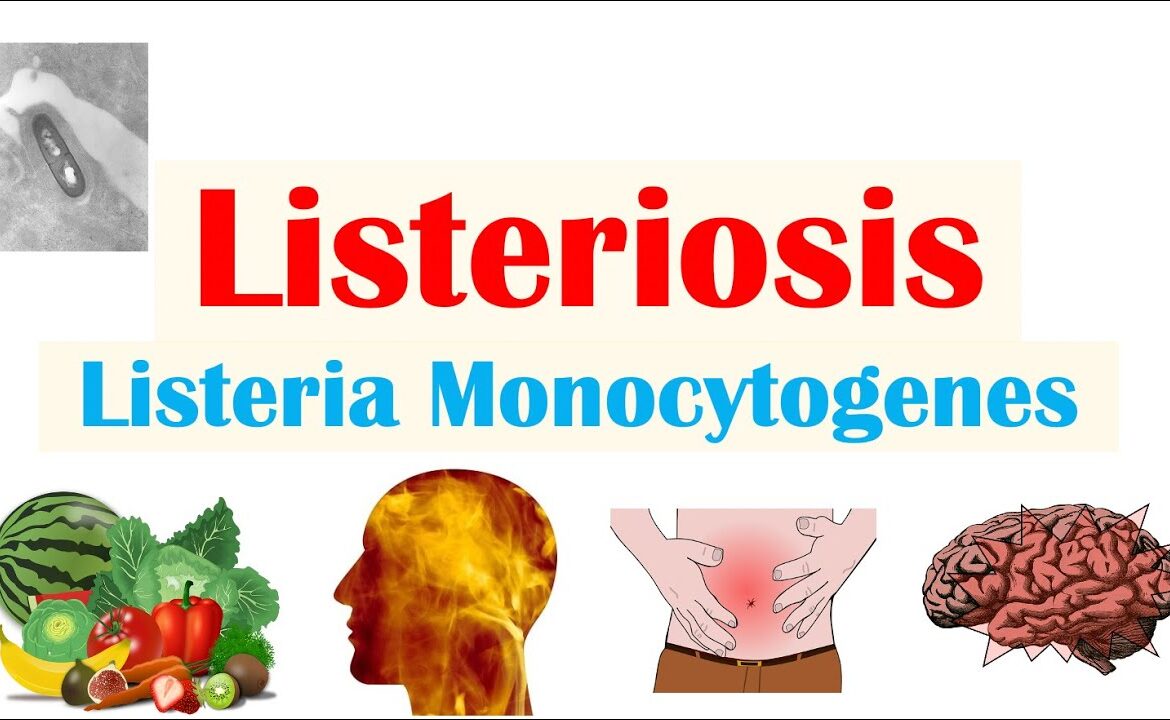 The Rise of Listeria: Health Risks and Recent Outbreaks