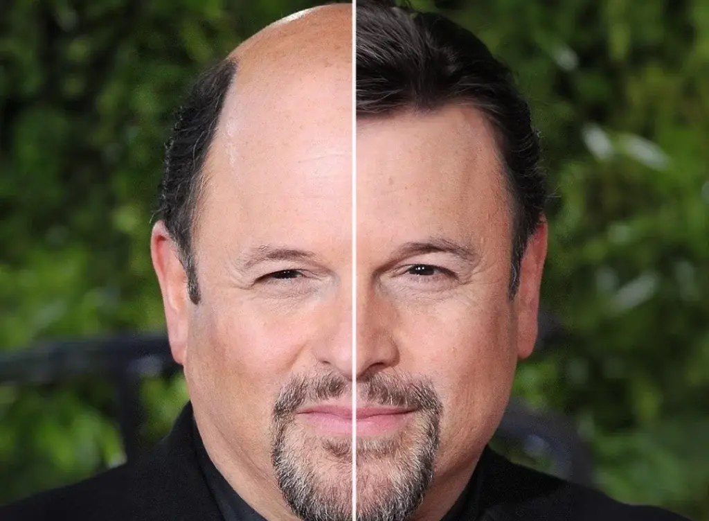 The Legacy of Jason Alexander: Comedian and Actor