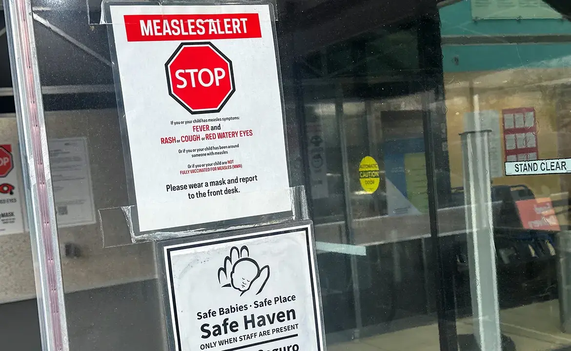 Measles Outbreak in Washington, DC: A Growing Concern